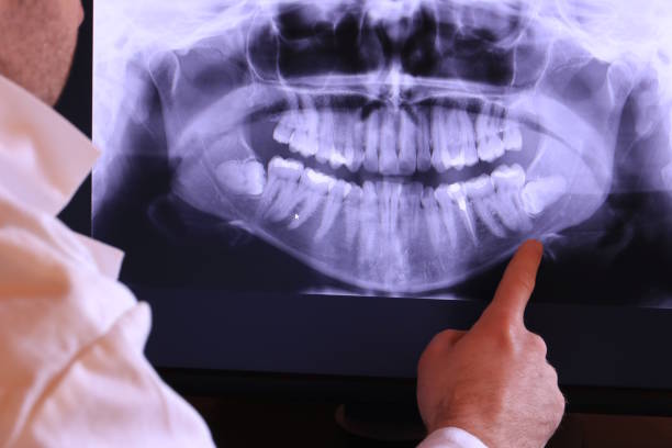 Best Broken Tooth Emergency  in Gilcrest, CO