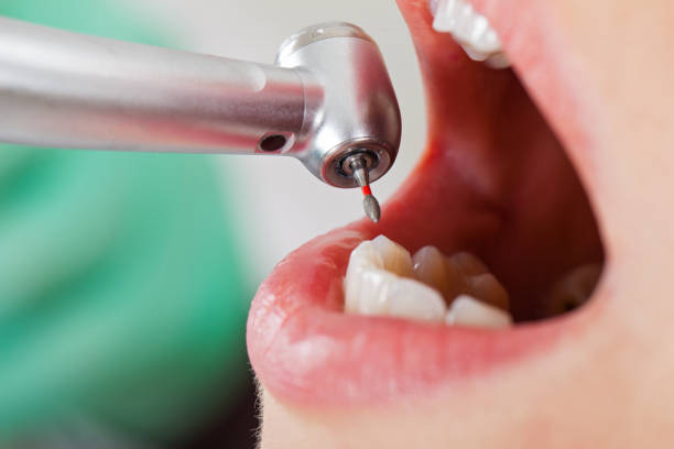 Best Broken Tooth Emergency  in Gilcrest, CO